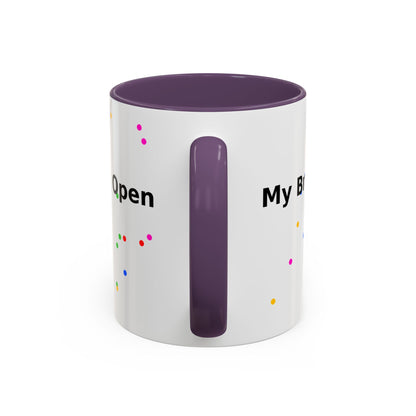 Coffee Mug - "My Brain Has Too Many Tabs Open" Funny Office Gift (11/15 oz)